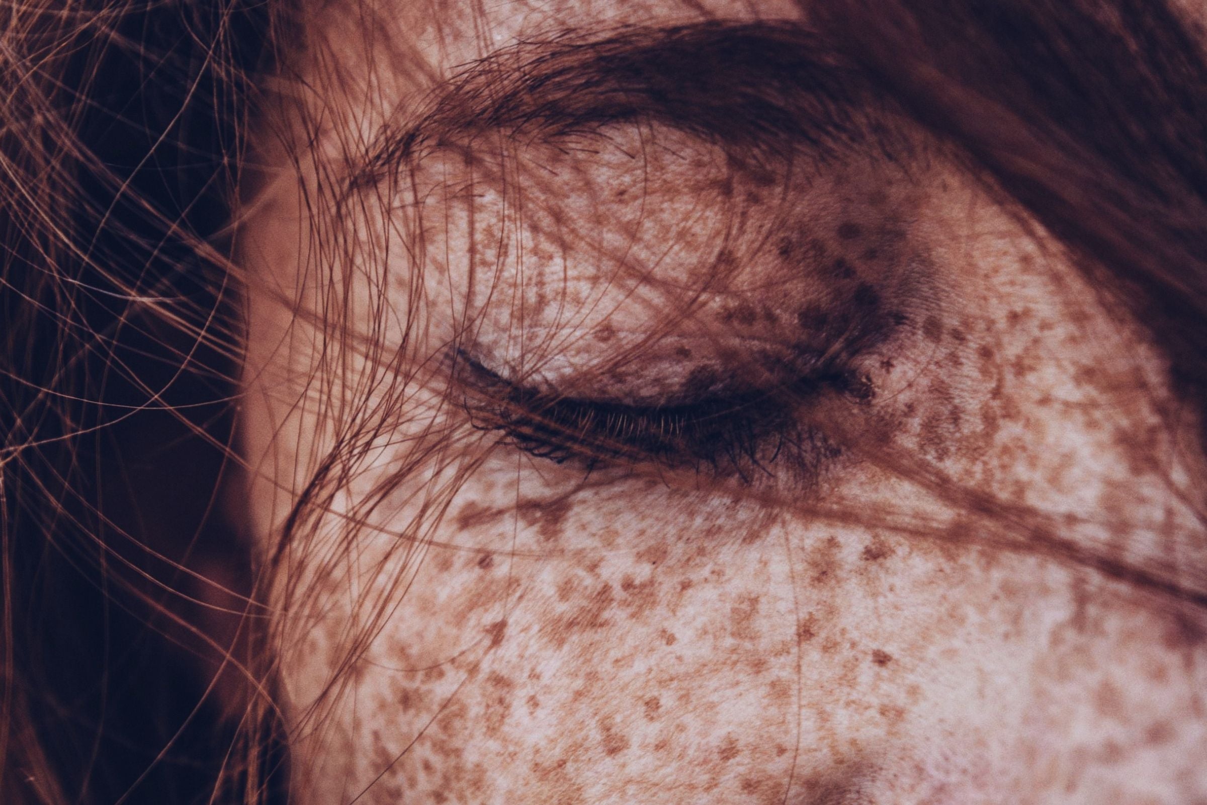Close up of freckled skin with closed eye in natural light, illustrating visible signs of extrinsic ageing such as sun damage and pigmentation alongside natural intrinsic skin changes