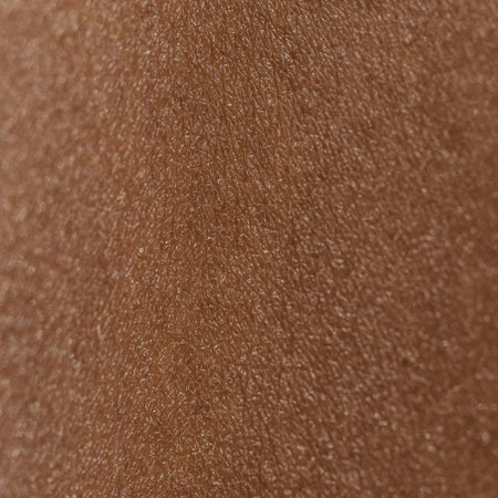 Image of dry skin